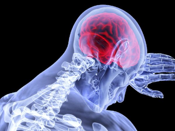 Brain stroke: These lifestyle habits could be increasing your risk