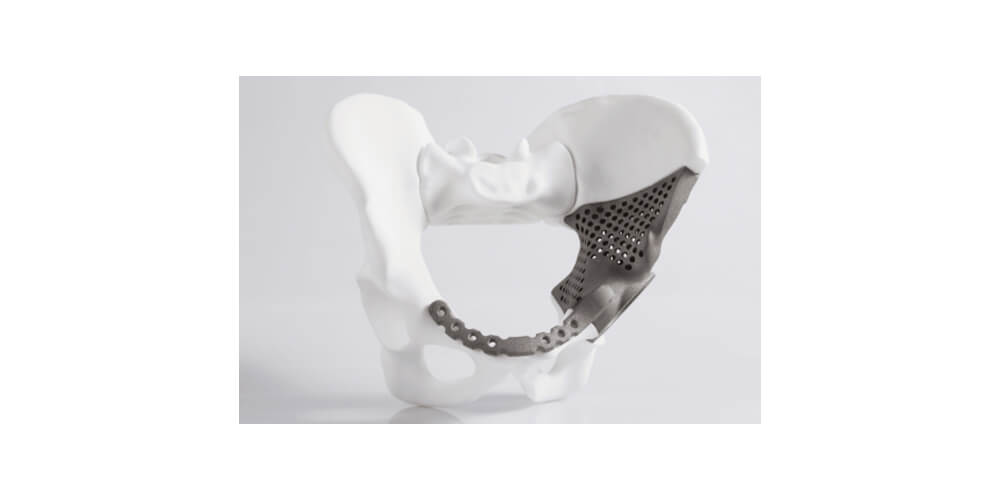 The Future of Rapid Prototyping in Medical Market