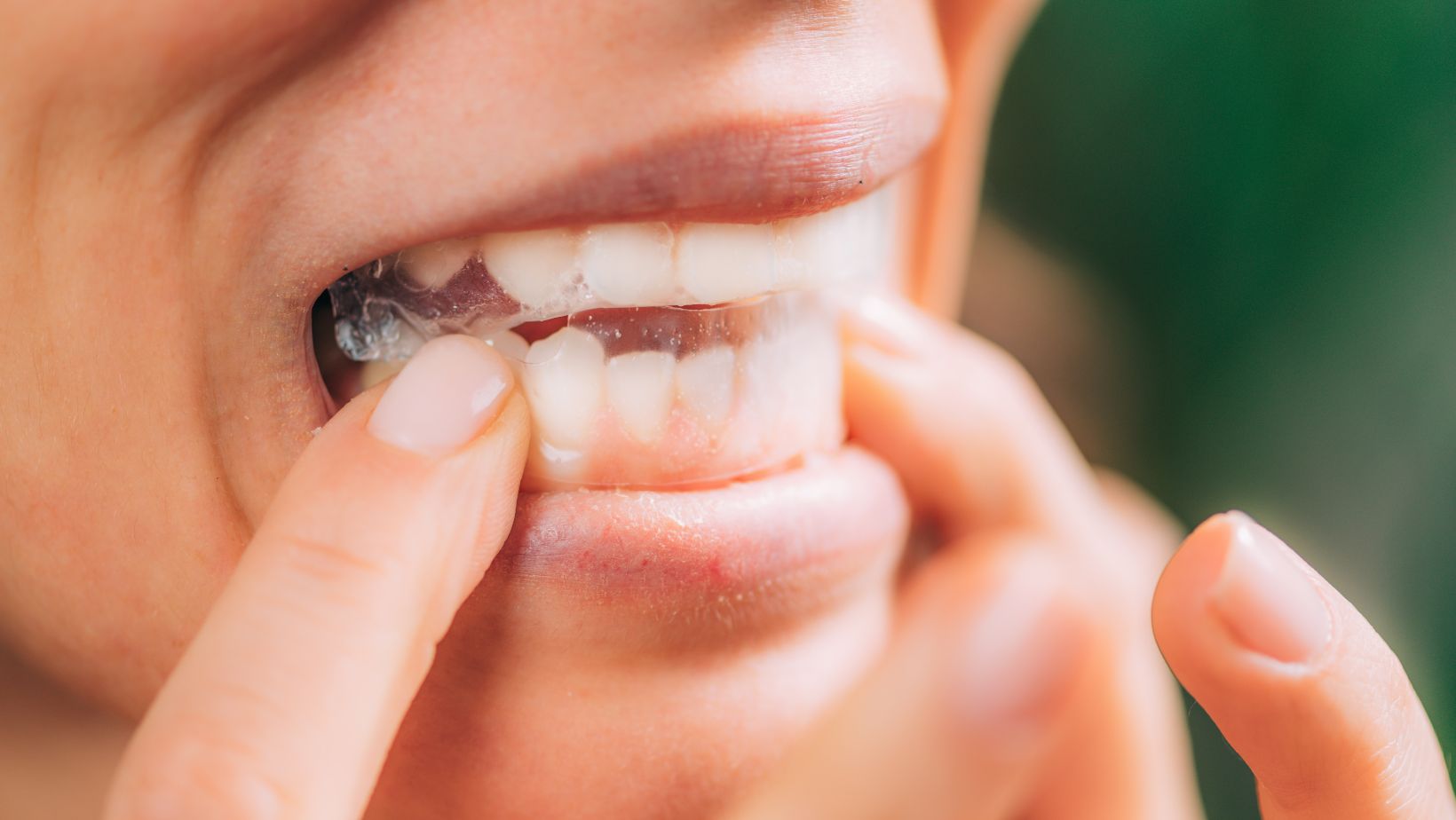 What are Cruelty Free Whitening Strips?