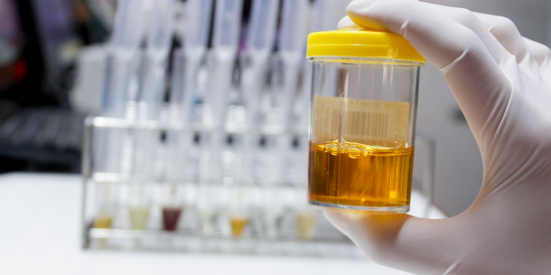 What Your Post-Water Pee Says About Your Hydration Levels